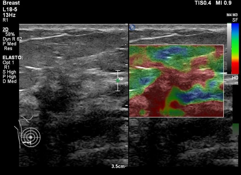 460637816 3976363029259319 1711523874452272069 n 768x560